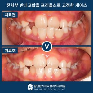 댓거리소아교정8