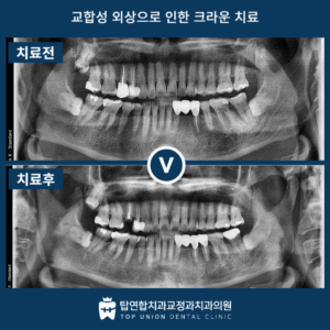 마산합포구치과5