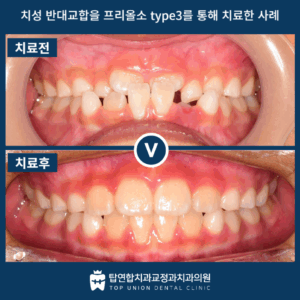 마산교정전문치과8