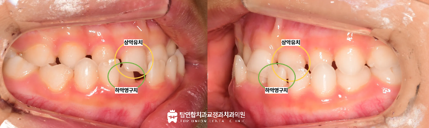 마산교정전문치과