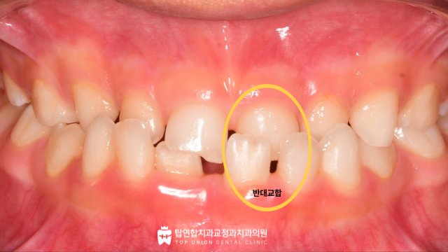 마산교정전문치과