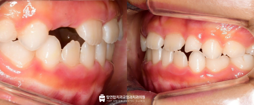 마산교정전문치과