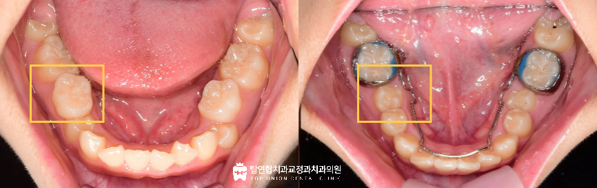 마산합포구교정치과